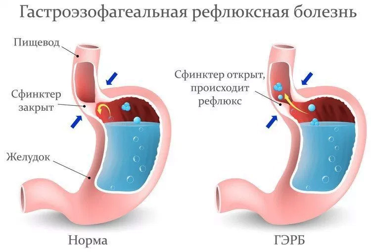 ГЭРБ ГЭРБ